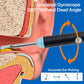 Smart Ear Camera Cleaner – Wireless HD Ear Wax Removal Kit