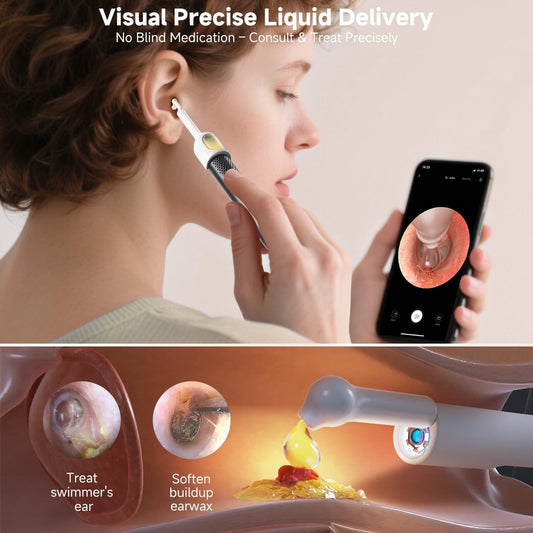 Smart Ear Camera Cleaner – Wireless HD Ear Wax Removal Kit